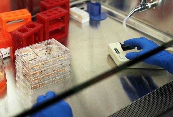 چاپ آنتی بادی انسان روی نانو زیست حسگر