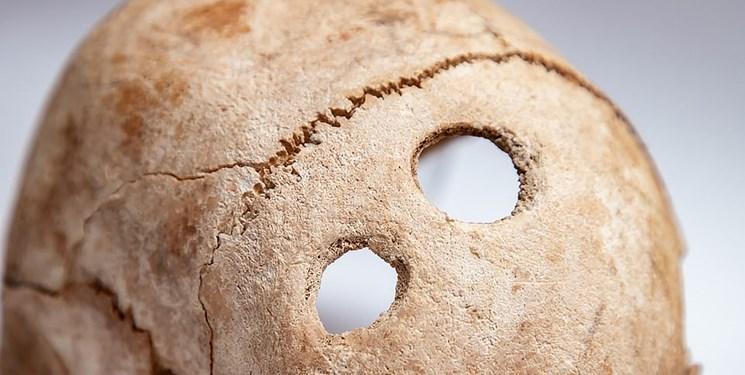 کشف سوراخ در جمجمه های باستانی