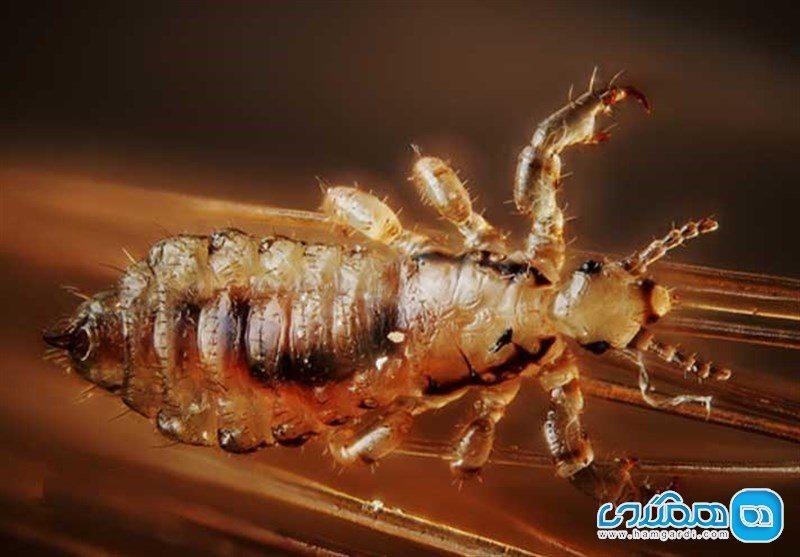 درمان سنتی برای نجات از شر شپش