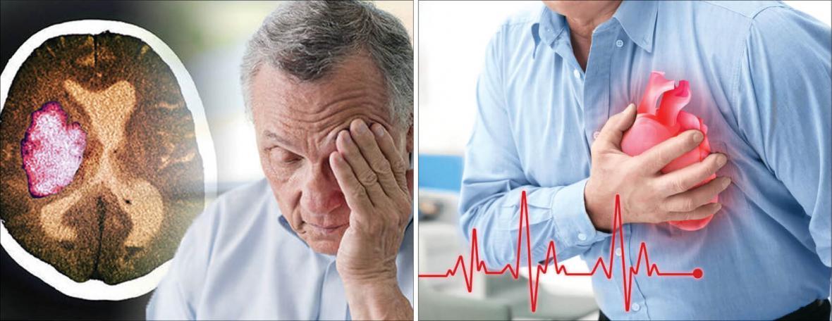 مقایسه علایم و نشانه های سکته قلبی و مغزی