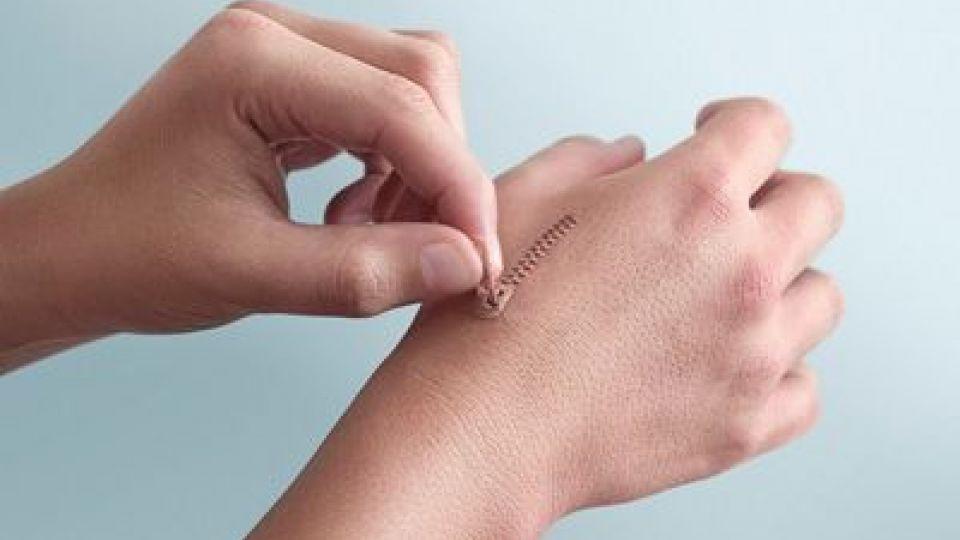 کنترل بهبود زخم ها با باند های حسگردار