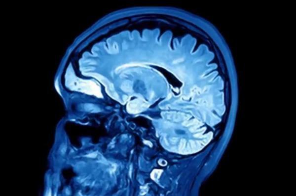 سکته خاموش شایع ترین خطر پس از جراحی در میانسالان