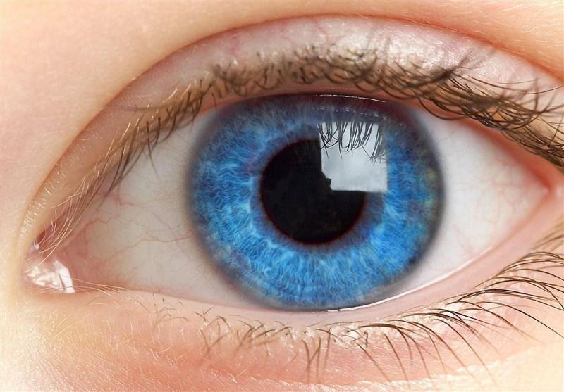 شایع ترین بیماری های چشمی را بشناسید