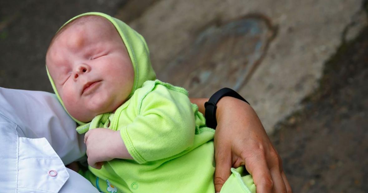 تولد نوزاد بدون چشم در روسیه!