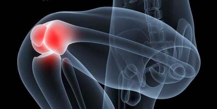 پروتئین هایی که به مداوای آرتروز پیشرفته یاری می نمایند