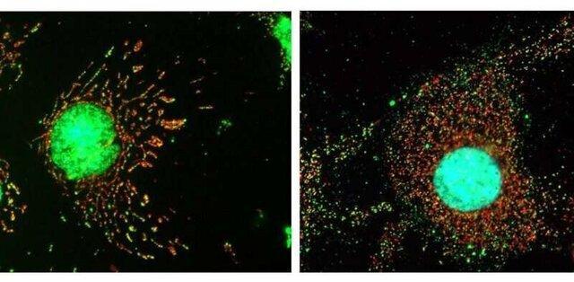 سلول ها چگونه از خود در برابر ویروس ها دفاع می نمایند؟