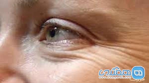 5 اشتباه رایج که اطراف چشم شما را چروک می کند 5 اشتباه رایج که اطراف چشم شما را چروک می نماید