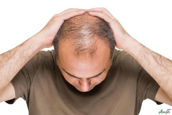 چگونه با استفاده از قهوه مانع ریزش موی خود شویم؟