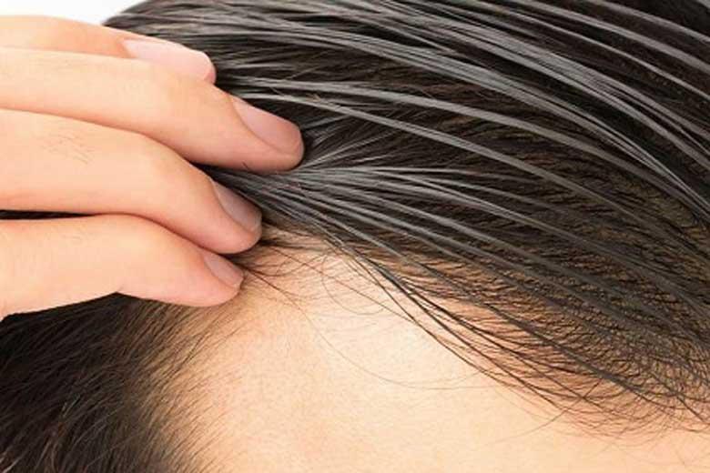 مو های خود را چند وقت یکبار بشوییم؟ مو های خود را چند وقت یکبار بشوییم؟