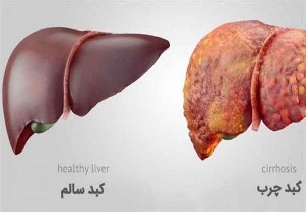 اگر این نشانه ها را دارید دچار مشکل حاد کبدی هستید