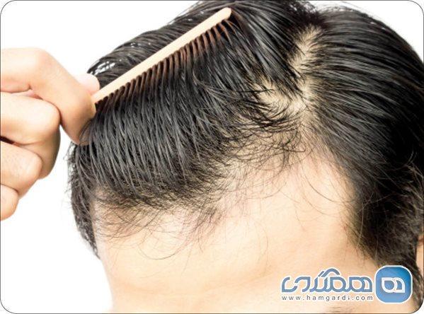 4 راه آنالیز سلامت مو