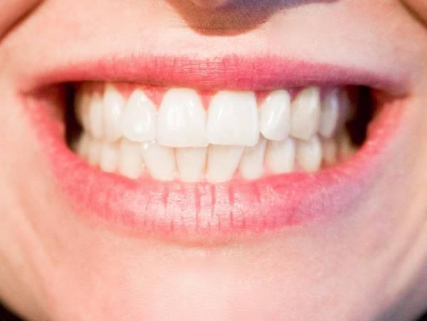 رازهای فوق العاده جذاب درباره دندان ها