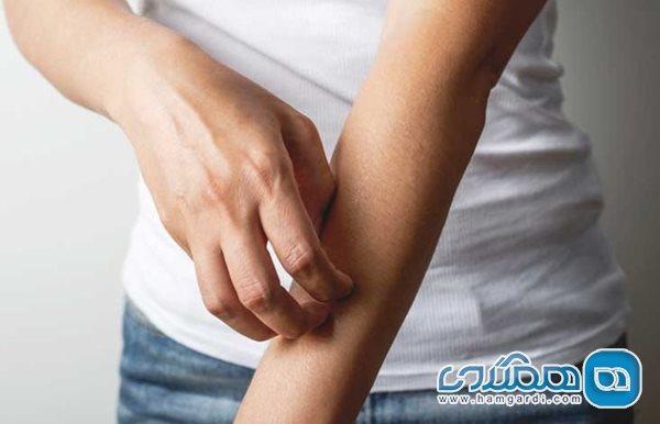 حس راه رفتن حشره روی پوست