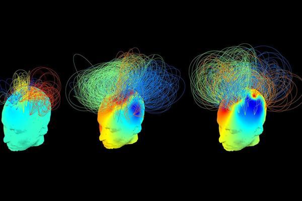 این دستگاه می تواند به پزشکان بگوید چقدر هوشیار هستید