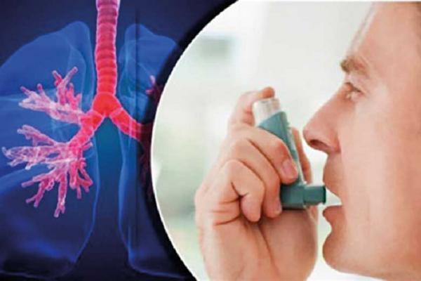 اصول روز ه داری در بیماران مبتلا به آسم