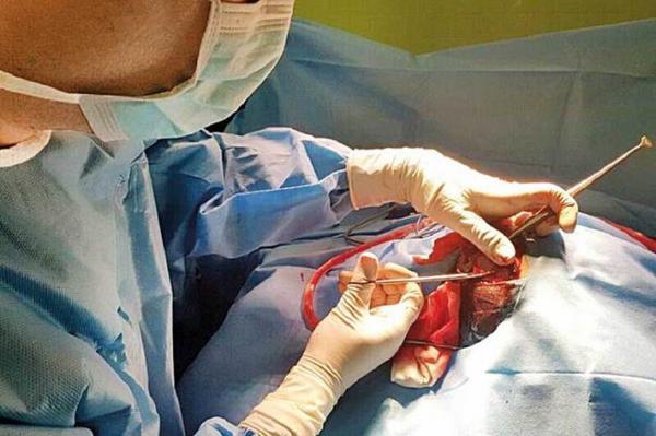 کلافه های شریانی - وریدی در مغز