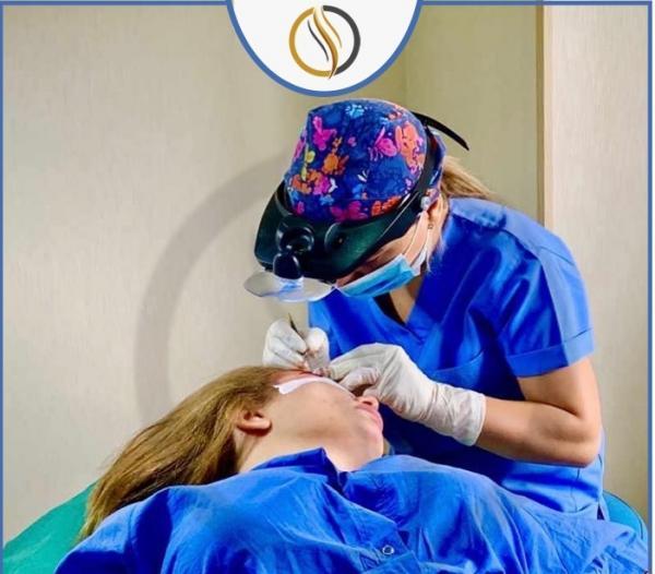 هزینه کاشت ابرو طبیعی ، مرکز کاشت ابرو ایندرا