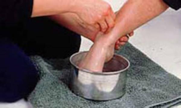 سرمازدگی و راه های پیشگیری