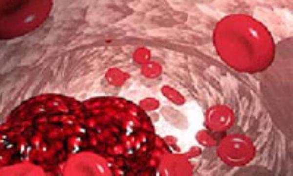 کم خونی ناشی از کمبود اسیدفولیک ـ anemia folic acid deficiency