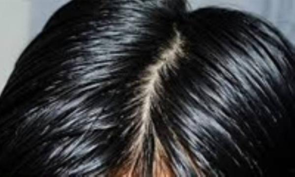 مراقبت از موی چرب مراقبت از موی چرب
