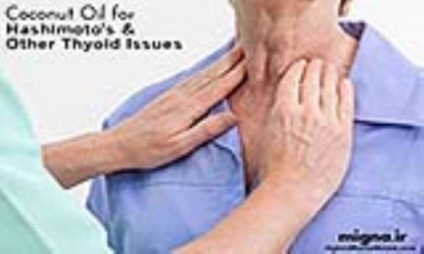 علائم تورم غده تیروئید