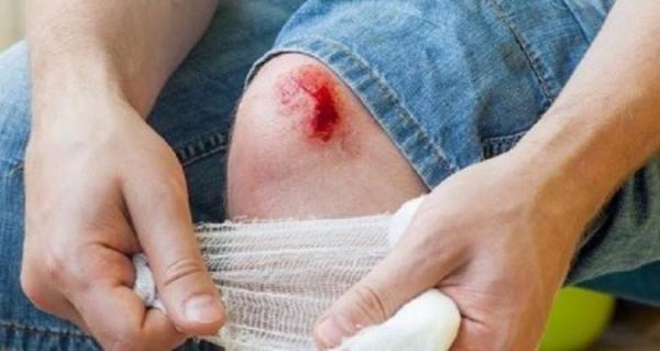 بیماری کزاز چیست و چه علائمی دارد؟