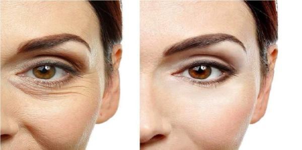 راجع به کربوکسی تراپی چه میدانید؟ راجع به کربوکسی تراپی چه میدانید؟